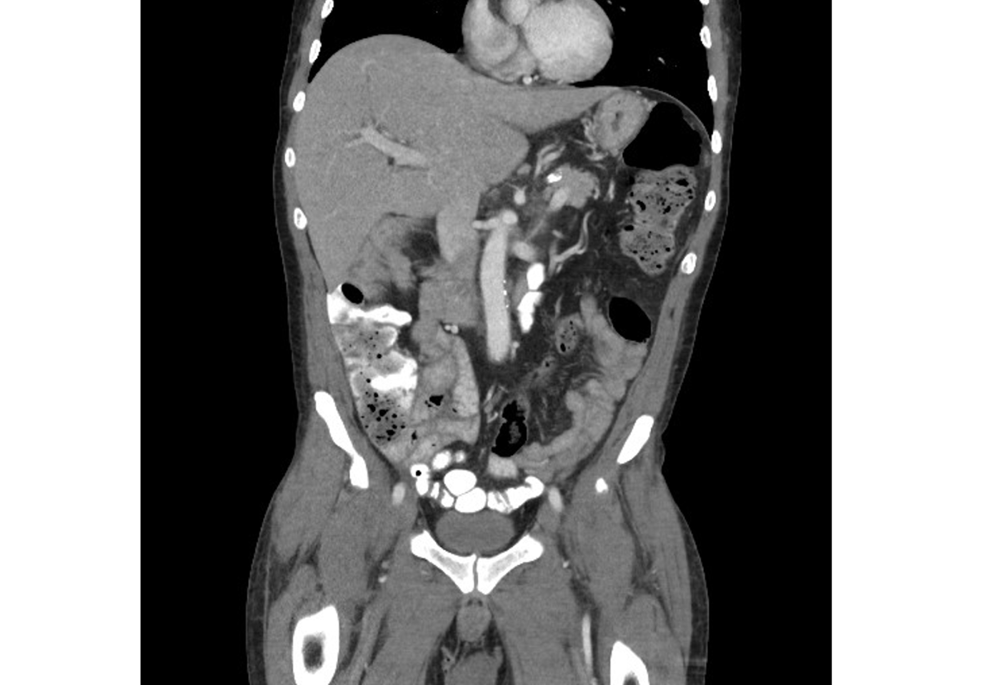 Abdominal Imaging