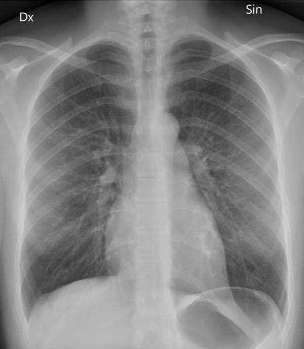 Chest Radiology