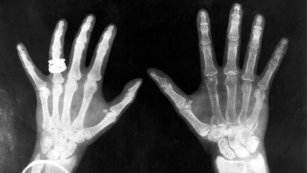 🎓 Session 1 Recap: Introduction to X-Ray in Clinical Radiology